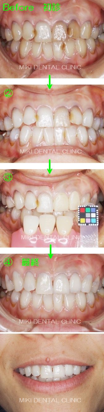 美希デンタルクリニックで治療を体験された皆様 （モニターの方）の